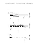 SYSTEMS FOR TREATING A HOLLOW ANATOMICAL STRUCTURE diagram and image