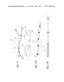 SYSTEMS FOR TREATING A HOLLOW ANATOMICAL STRUCTURE diagram and image