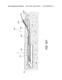 SYSTEMS FOR TREATING A HOLLOW ANATOMICAL STRUCTURE diagram and image