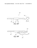 SYSTEMS FOR TREATING A HOLLOW ANATOMICAL STRUCTURE diagram and image