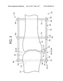 Orthopedic external fixator and method of use diagram and image