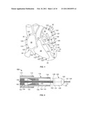 DELIVERY OF CARDIAC STIMULATION DEVICES diagram and image