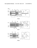 DELIVERY OF CARDIAC STIMULATION DEVICES diagram and image