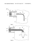 DELIVERY OF CARDIAC STIMULATION DEVICES diagram and image