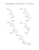 DELIVERY OF CARDIAC STIMULATION DEVICES diagram and image