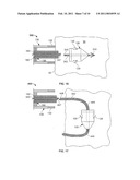 DELIVERY OF CARDIAC STIMULATION DEVICES diagram and image