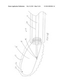 Surgical Instrument for Hernia Repair and Method diagram and image