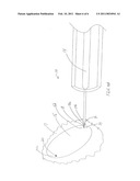 Surgical Instrument for Hernia Repair and Method diagram and image