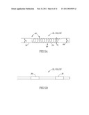 SYSTEMS AND METHODS FOR TREATING A VESSEL USING FOCUSED FORCE diagram and image