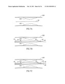 SYSTEMS AND METHODS FOR TREATING A VESSEL USING FOCUSED FORCE diagram and image