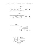 SYSTEMS AND METHODS FOR TREATING A VESSEL USING FOCUSED FORCE diagram and image