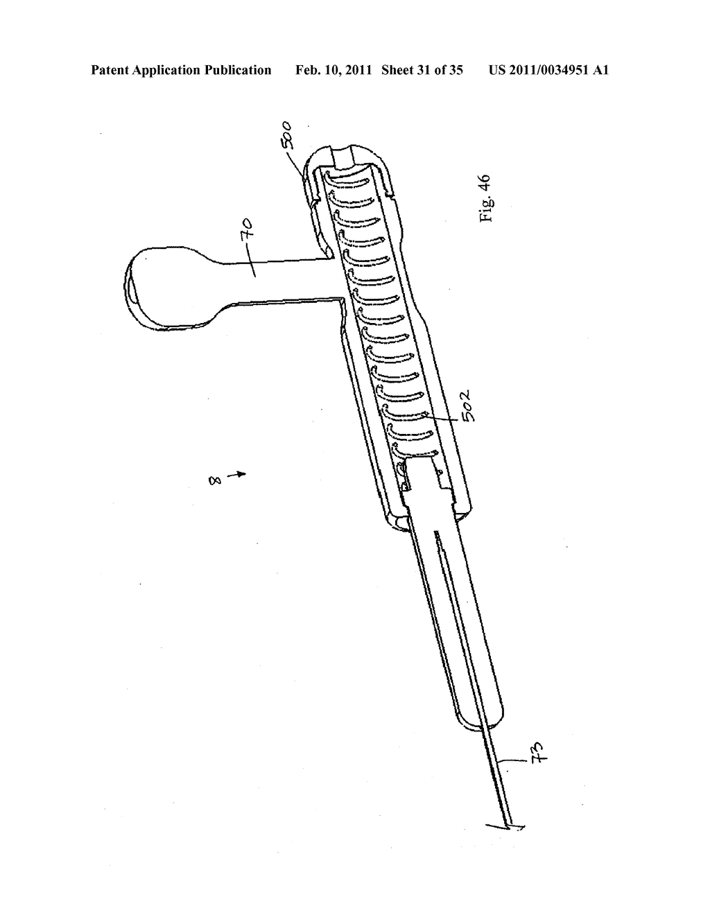 DEVICE FOR LOADING AN EMBOLIC PROTECTION FILTER INTO A CATHETER - diagram, schematic, and image 32