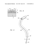 SUTURELESS REINFORCEMENT FOR AND METHOD OF TREATING A MYOCARDIAL INFARCTION diagram and image