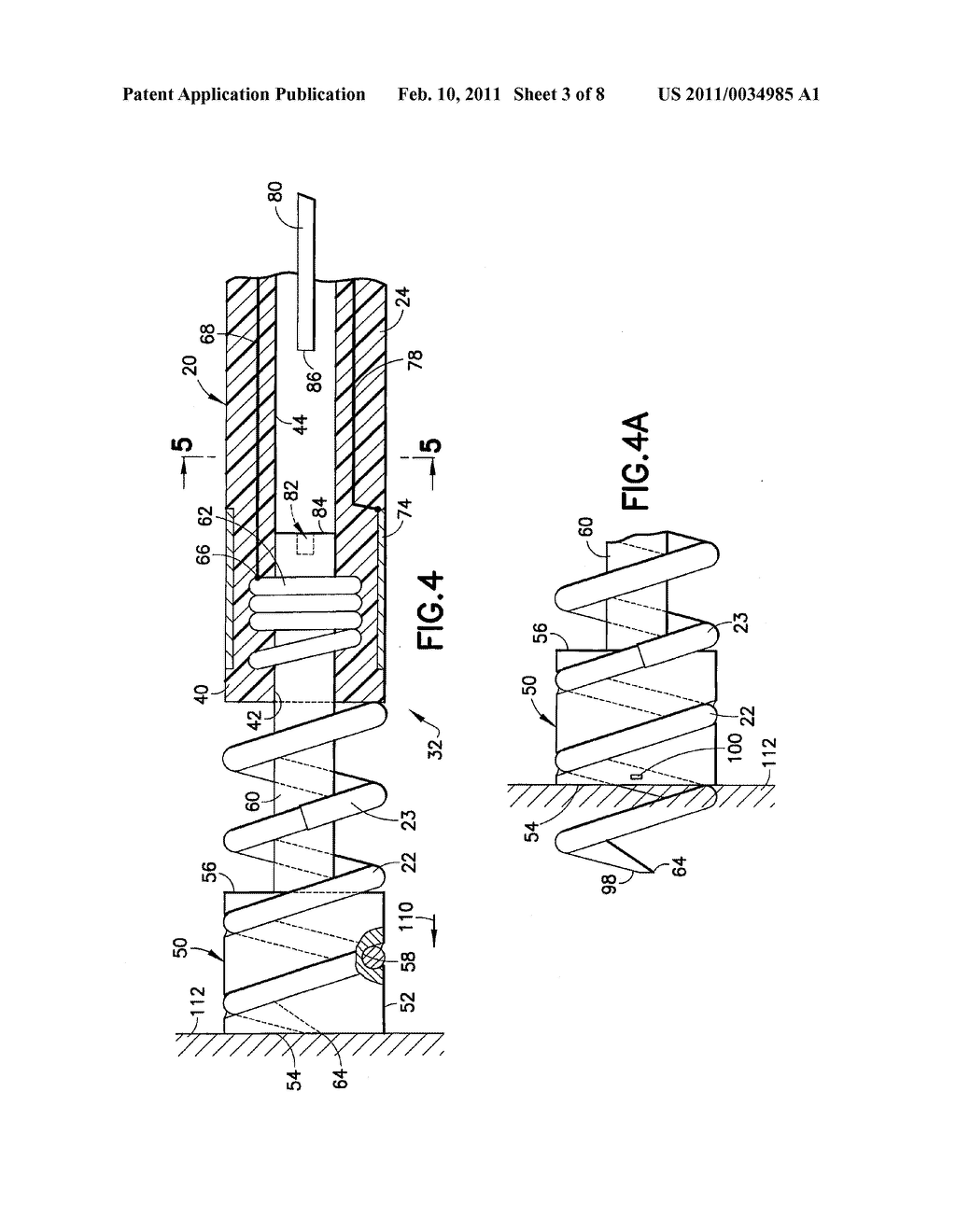 BIPOLAR SCREW-IN LEAD - diagram, schematic, and image 04