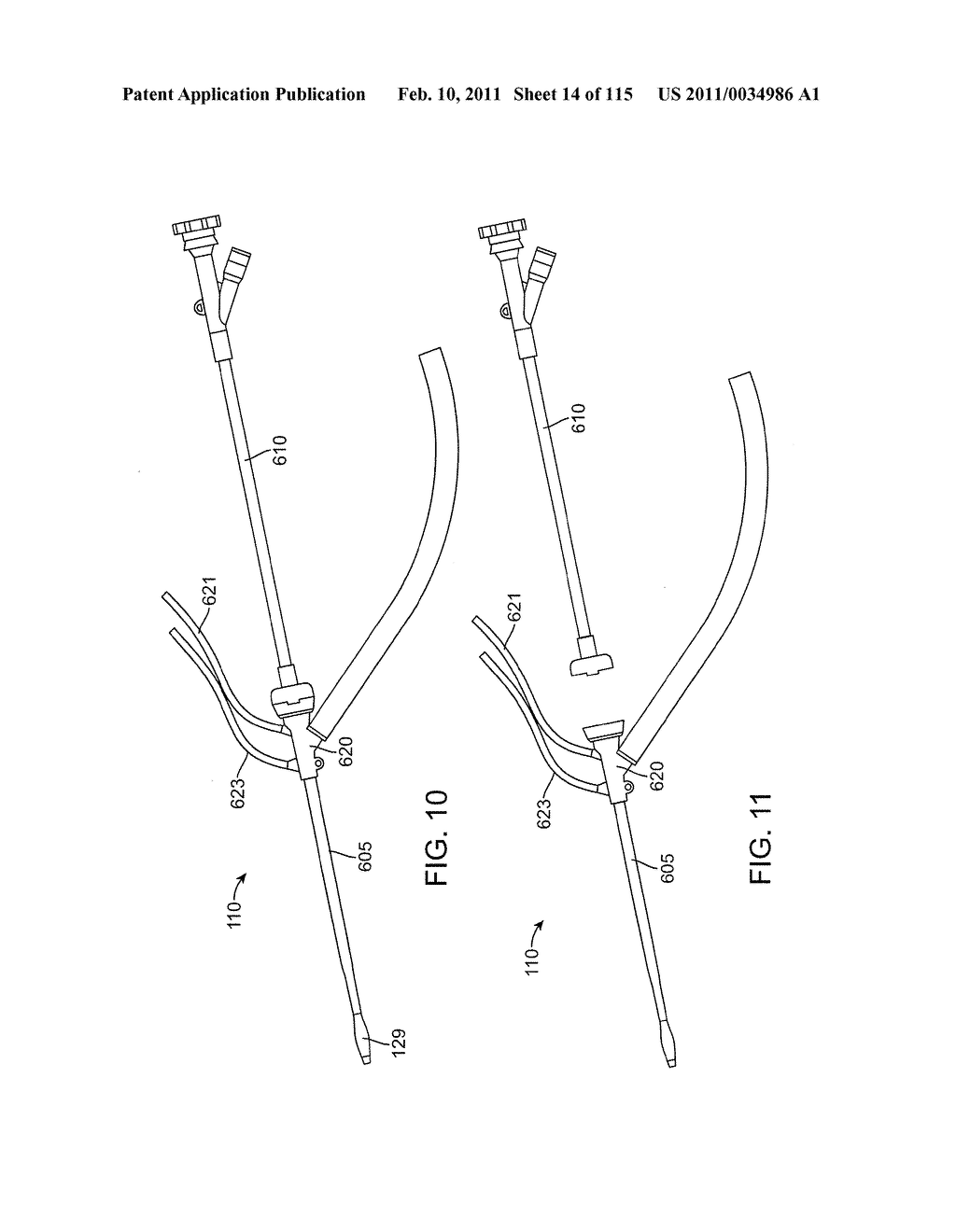 SYSTEMS AND METHODS FOR TREATING A CAROTID ARTERY - diagram, schematic, and image 15