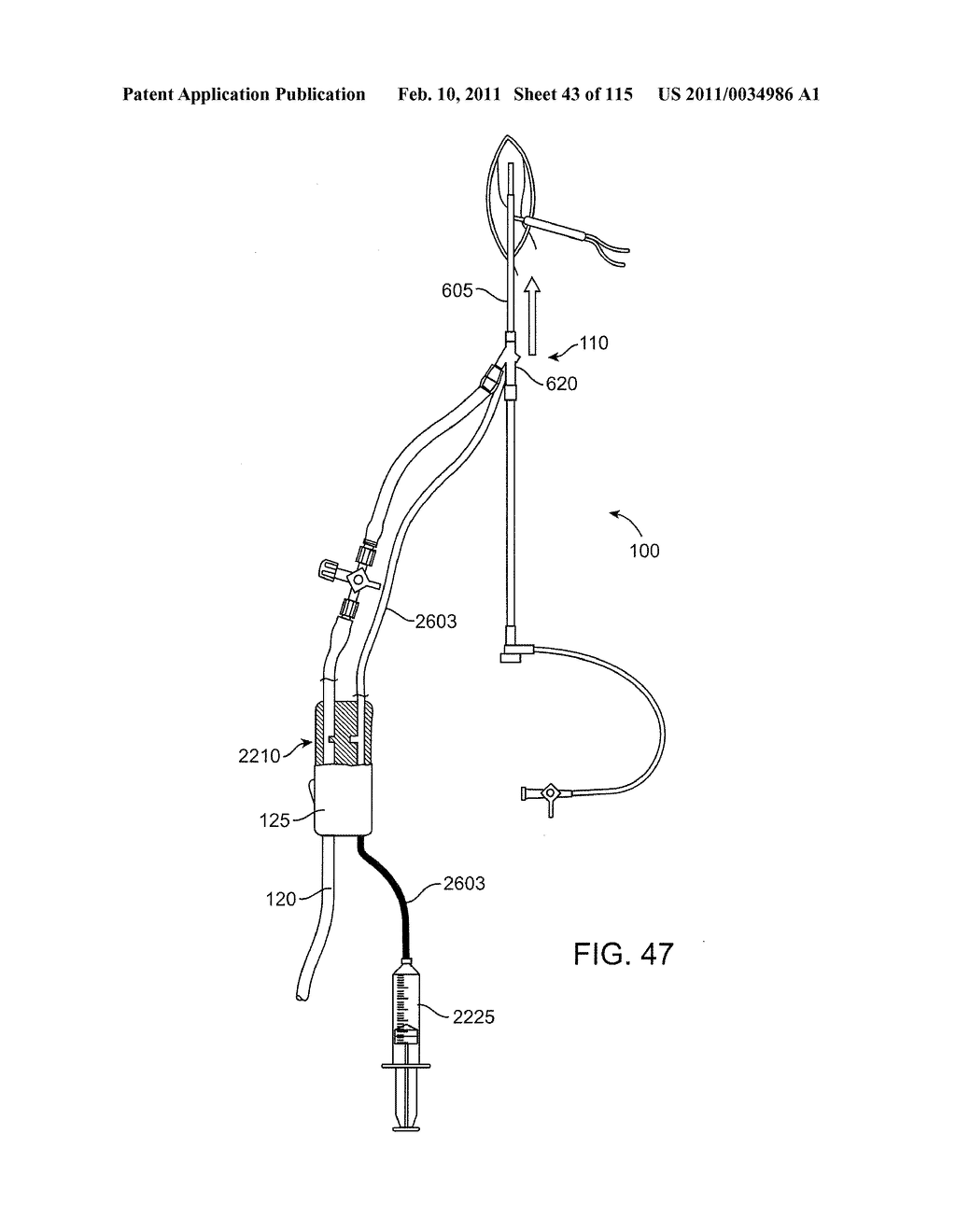 SYSTEMS AND METHODS FOR TREATING A CAROTID ARTERY - diagram, schematic, and image 44