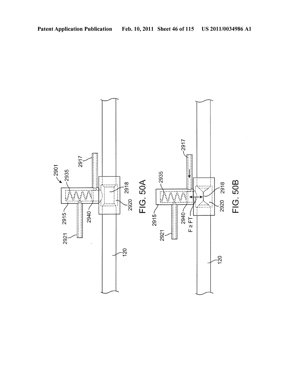 SYSTEMS AND METHODS FOR TREATING A CAROTID ARTERY - diagram, schematic, and image 47