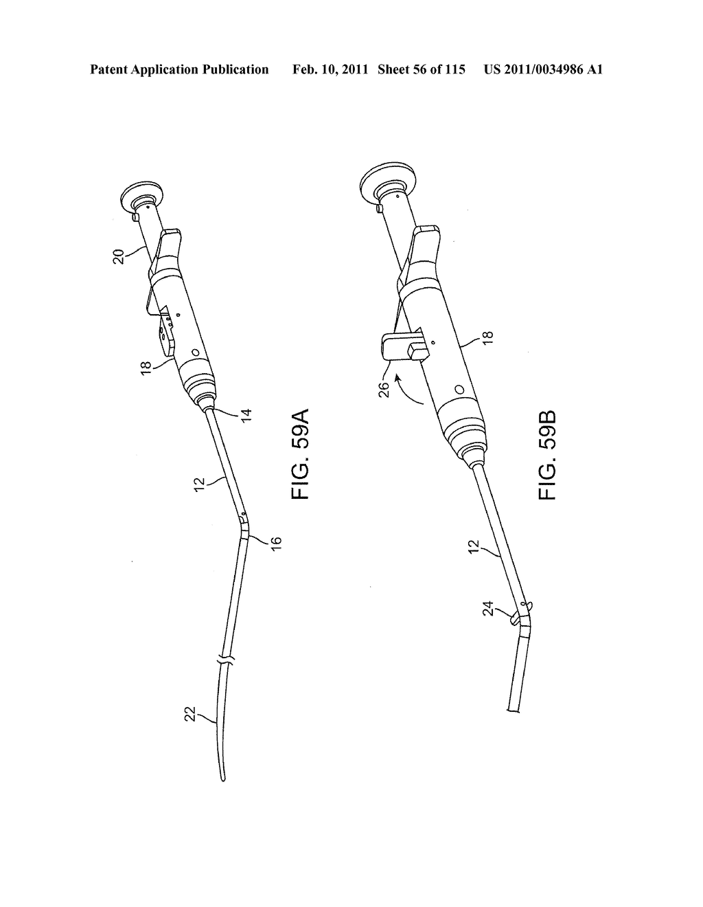 SYSTEMS AND METHODS FOR TREATING A CAROTID ARTERY - diagram, schematic, and image 57