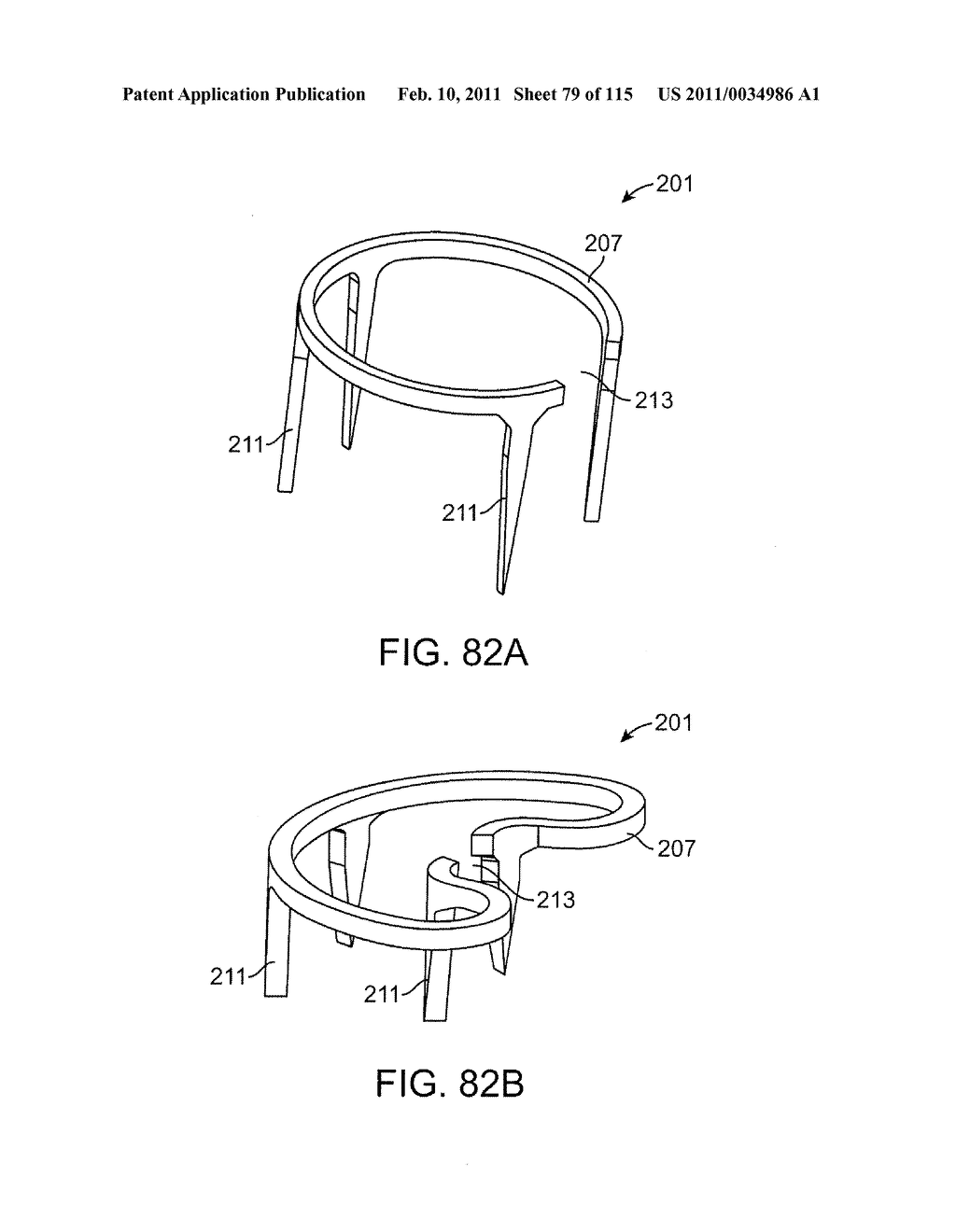 SYSTEMS AND METHODS FOR TREATING A CAROTID ARTERY - diagram, schematic, and image 80