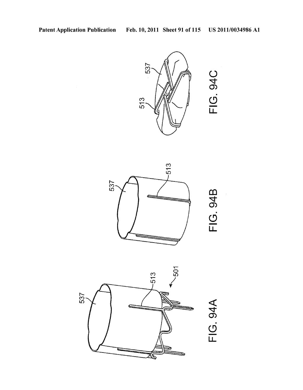 SYSTEMS AND METHODS FOR TREATING A CAROTID ARTERY - diagram, schematic, and image 92