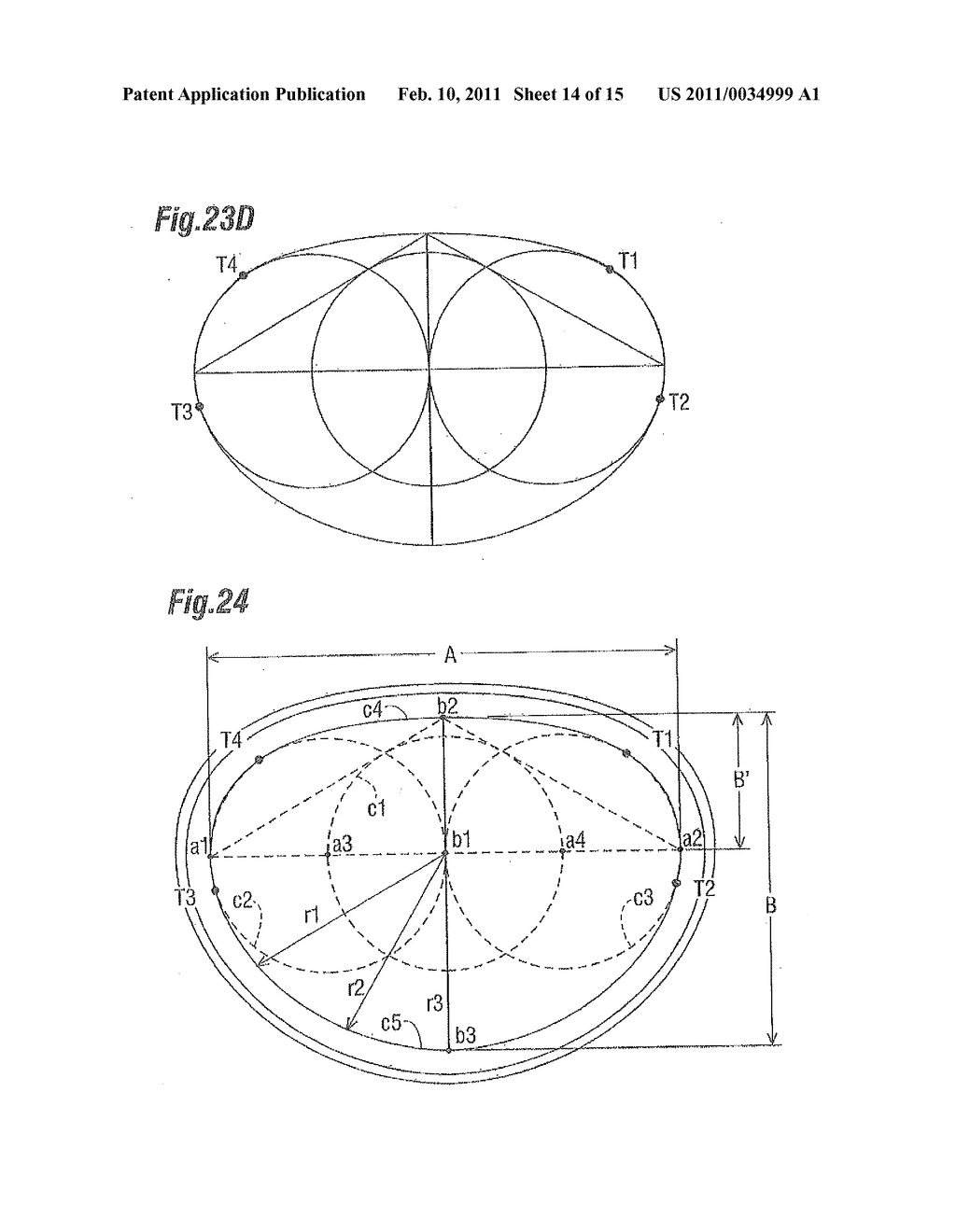 DEGENERATIVE VALVULAR DISEASE SPECIFIC ANNULOPLASTY RINGS - diagram, schematic, and image 15