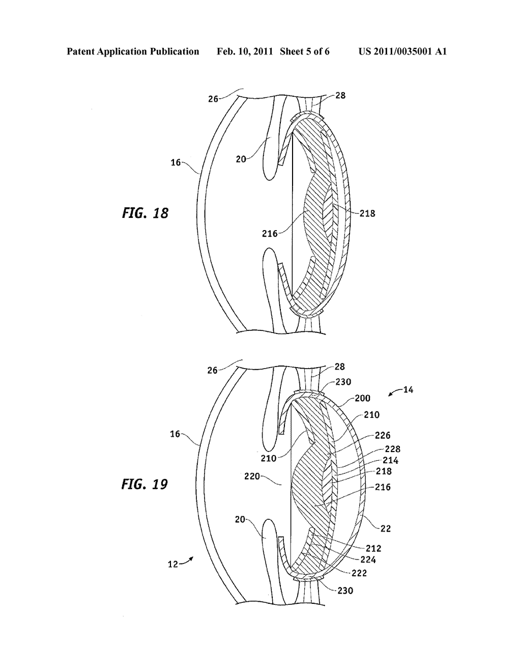 ACCOMMODATING INTRAOCULAR LENSES - diagram, schematic, and image 06