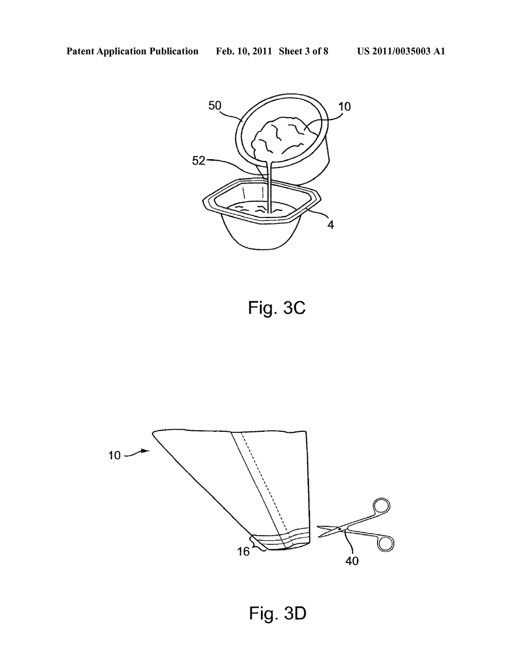 Fail-Safe Silicone Breast Implant Delivery Device - diagram, schematic, and image 04