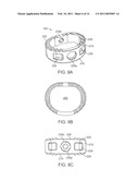 STAND-ALONE INTERBODY FIXATION SYSTEM diagram and image