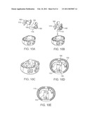 STAND-ALONE INTERBODY FIXATION SYSTEM diagram and image