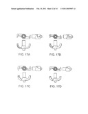 STAND-ALONE INTERBODY FIXATION SYSTEM diagram and image