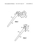 SHOULDER PROTHESIS diagram and image