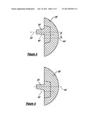 SHOULDER PROTHESIS diagram and image