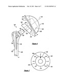 SHOULDER PROTHESIS diagram and image