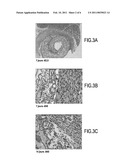 PROSTHESIS FOR PROMOTING THE IN VIVO RECONSTRUCTION OF A HOLLOW ORGAN OR A PORTION OF A HOLLOW ORGAN diagram and image