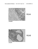 PROSTHESIS FOR PROMOTING THE IN VIVO RECONSTRUCTION OF A HOLLOW ORGAN OR A PORTION OF A HOLLOW ORGAN diagram and image