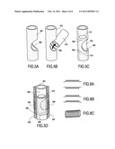 PROSTHESIS FOR PROMOTING THE IN VIVO RECONSTRUCTION OF A HOLLOW ORGAN OR A PORTION OF A HOLLOW ORGAN diagram and image