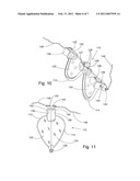 FOLDING EYEGLASSES diagram and image