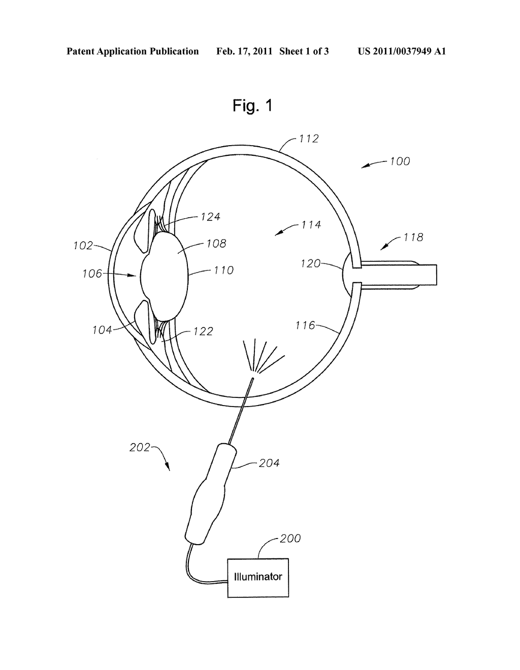 OPHTHALMIC ENDOILLUMINATION WITH THERMALLY ISOLATED PHOSPHOR - diagram, schematic, and image 02