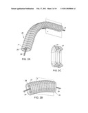 Flexible Arms of Low Footprint and High Weight-bearing diagram and image