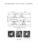 Device and Method for Transfecting Cells for Therapeutic Use diagram and image