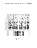 METHODS AND NUCLEIC ACIDS FOR THE ANALYSES OF CELLULAR PROLIFERATIVE DISORDERS diagram and image