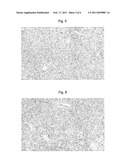 CARBOSTYRIL DERIVATIVES INCLUDING CILOSTAZOL FOR TREATING FATTY LIVER diagram and image