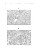 CARBOSTYRIL DERIVATIVES INCLUDING CILOSTAZOL FOR TREATING FATTY LIVER diagram and image