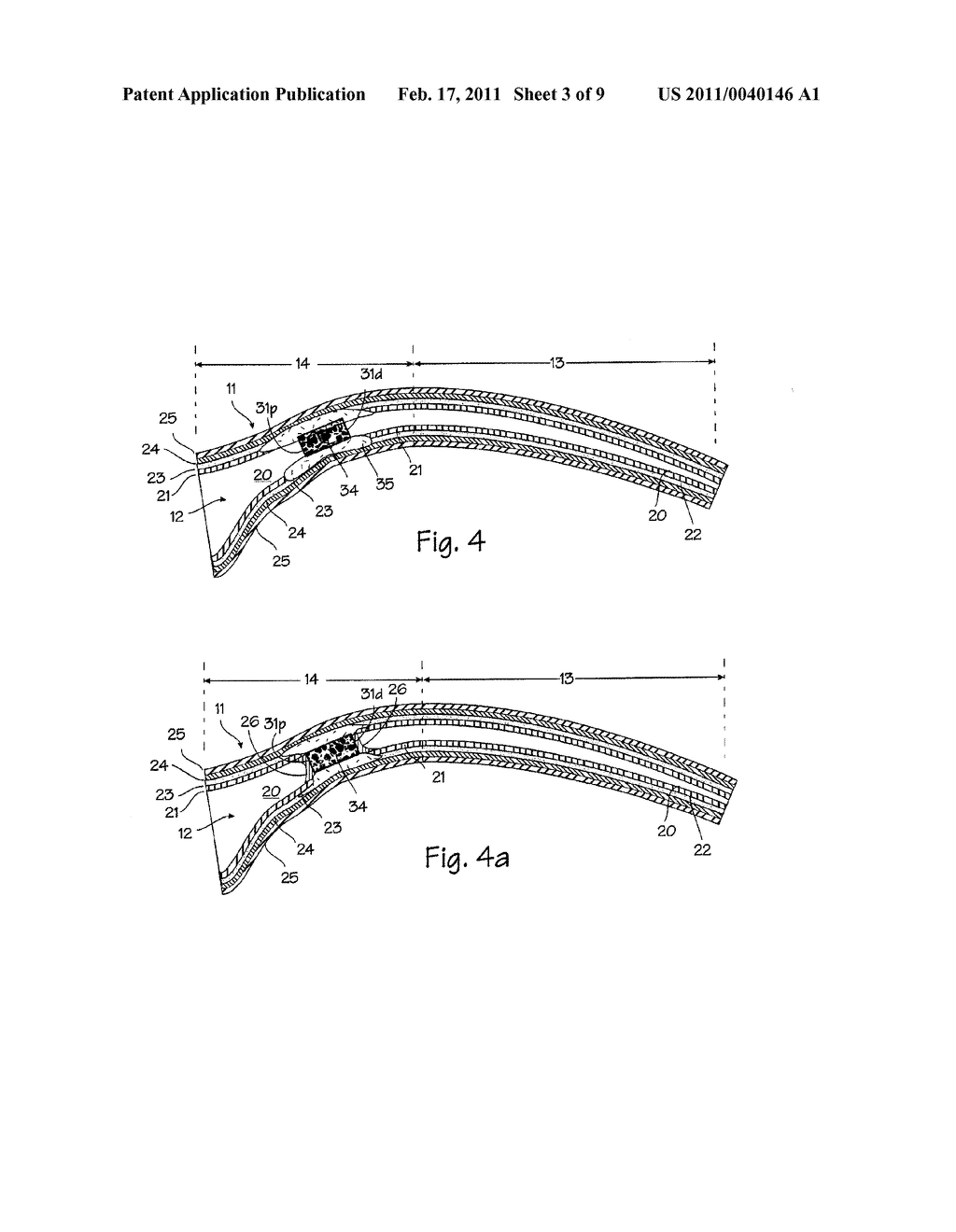 Method and Apparatus for Tubal Occlusion - diagram, schematic, and image 04