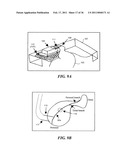 IMAGE GUIDED HIGH INTENSITY FOCUSED ULTRASOUND TREATMENT OF NERVES diagram and image