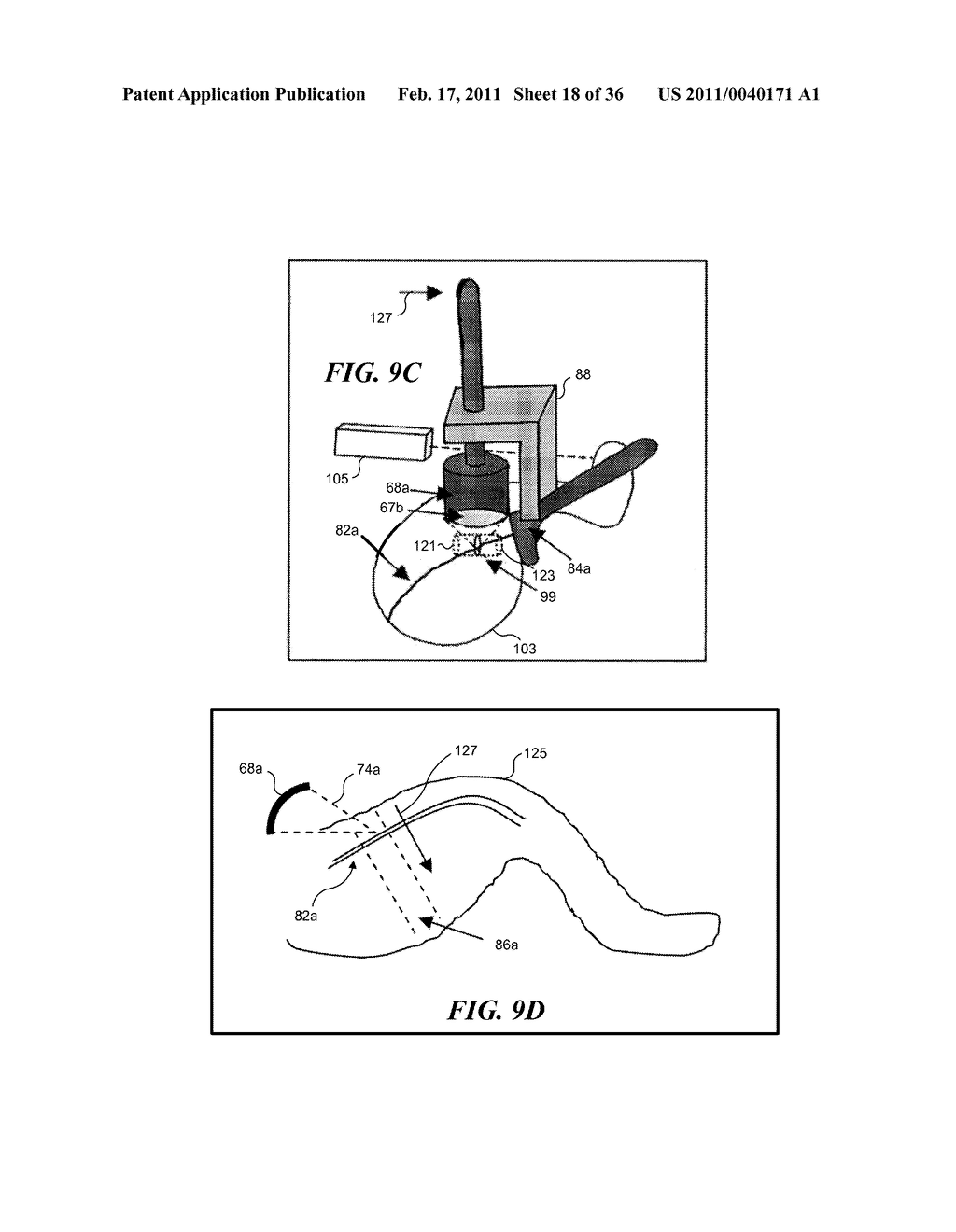 IMAGE GUIDED HIGH INTENSITY FOCUSED ULTRASOUND TREATMENT OF NERVES - diagram, schematic, and image 19