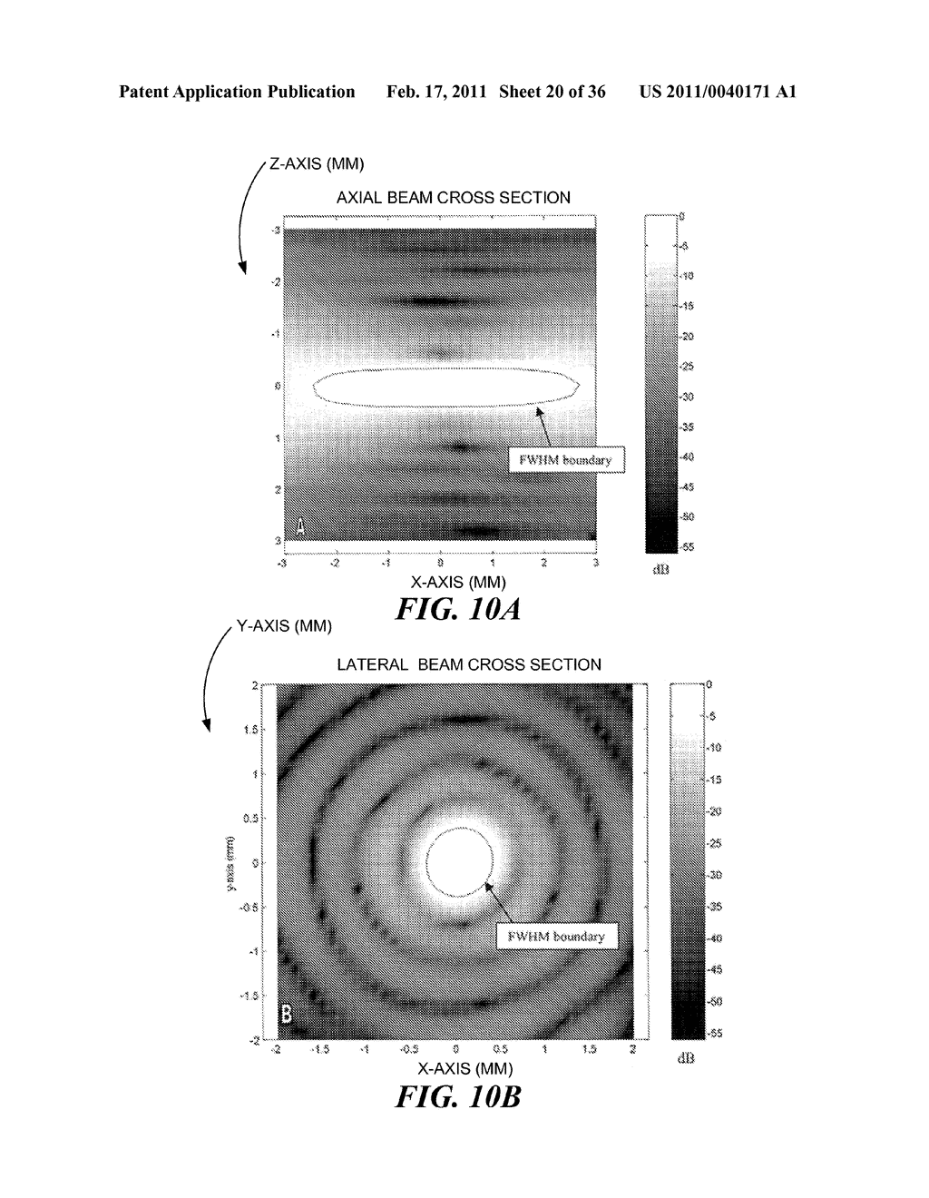 IMAGE GUIDED HIGH INTENSITY FOCUSED ULTRASOUND TREATMENT OF NERVES - diagram, schematic, and image 21