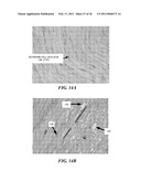 IMAGE GUIDED HIGH INTENSITY FOCUSED ULTRASOUND TREATMENT OF NERVES diagram and image