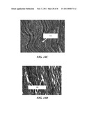 IMAGE GUIDED HIGH INTENSITY FOCUSED ULTRASOUND TREATMENT OF NERVES diagram and image