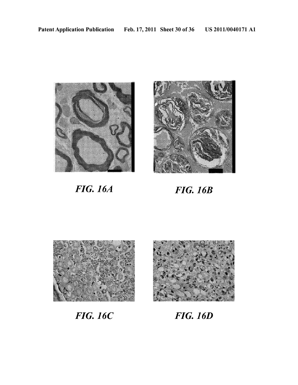 IMAGE GUIDED HIGH INTENSITY FOCUSED ULTRASOUND TREATMENT OF NERVES - diagram, schematic, and image 31